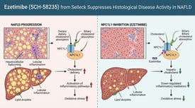 Ezetimibe (SCH-58235) from Selleck Suppresses Histological Disease Activity in NAFLD